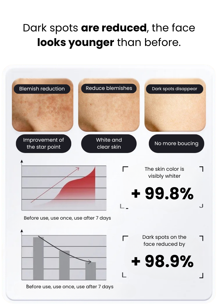 Dark Spot Remover Spray 577